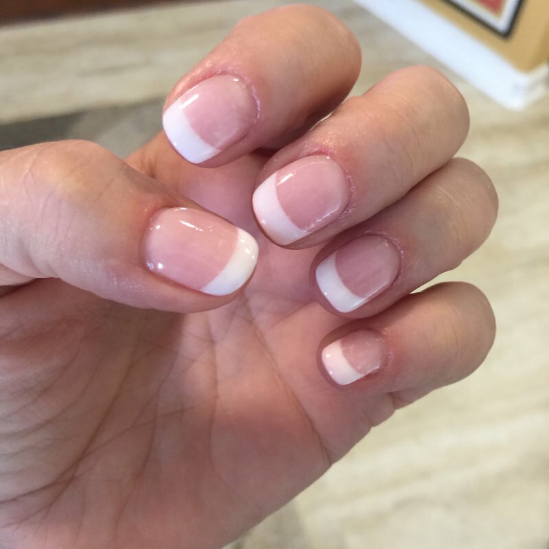 treat an allergic reaction to gel nail polish